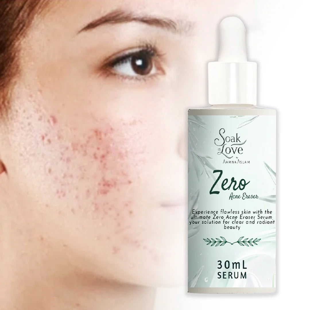 Soak in Love Zero Acne Eraser Serum 30ml